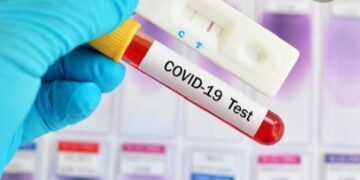 Pasien Positif COVID-19 di NTT Tambah 12 Orang, Total 59 Kasus