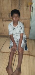 Yanti Penyandang Disabilitas Dari Desa Tou Timur  Ende, Tiga Tahun  Tidak Terima Bansos