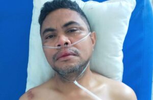 Wartawan Faby Latuan Dikeroyok Sekelompok Orang Bercadar