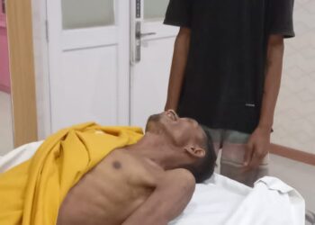 Calo Telantarkan Tenaga Kerja Hingga Meninggal Dunia