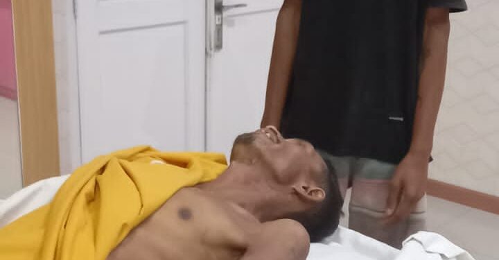 Calo Telantarkan Tenaga Kerja Hingga Meninggal Dunia