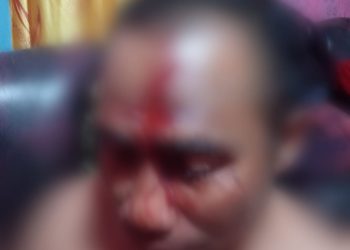 Kisah Tragis Muhamad Suhardin Korban Penganiayaan