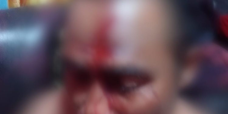 Kisah Tragis Muhamad Suhardin Korban Penganiayaan