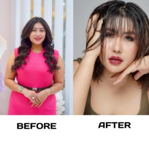 Operasi Kedua di Korea Selatan, Aprilia Sky Tampil Lebih Muda dan Percaya Diri