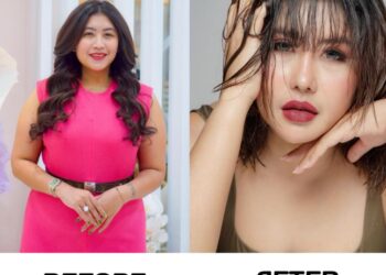 Operasi Kedua di Korea Selatan, Aprilia Sky Tampil Lebih Muda dan Percaya Diri